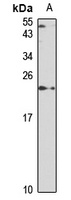 SAT1 antibody