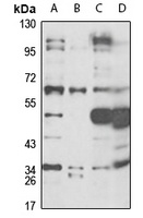 Anti-CD36 Antibody