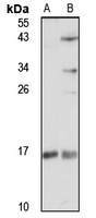 Anti-SDHAF2 Antibody