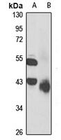 Anti-Serpin A7 Antibody