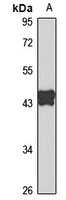 Anti-PAI1 Antibody