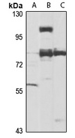 Anti-SETDB2 Antibody