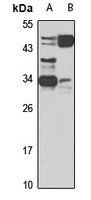 Anti-SFRP1 Antibody