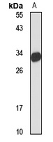 Anti-SARP3 Antibody