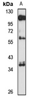 Surfactant Protein D antibody