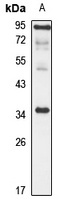 Gamma-sarcoglycan antibody