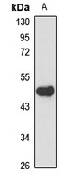 Anti-SMS1 Antibody