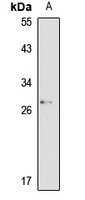 Anti-SLA2 Antibody