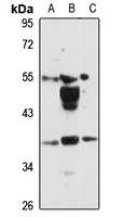 SLC10A2 antibody