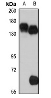 Anti-SLC12A1 Antibody