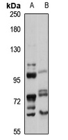 SLC14A2 antibody