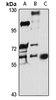 SLC22A6 antibody