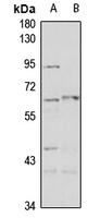 Anti-PAHT Antibody