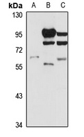 SLC22A7 antibody