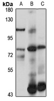 SLC22A9 antibody