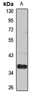 Anti-SLC25A19 Antibody