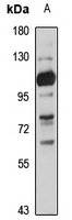 Anti-SLC28A3 Antibody