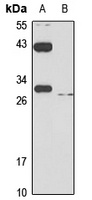 SLC31A1 antibody