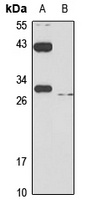 Anti-SLC31A1 Antibody