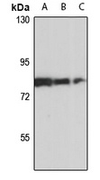 NaPi-2b antibody