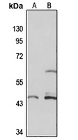 Anti-SLC37A4 Antibody