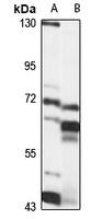 SLC5A9 antibody