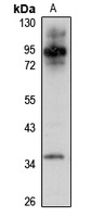 Anti-Dopamine Transporter Antibody
