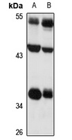 SLC7A11 antibody