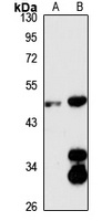 SLC7A9 antibody