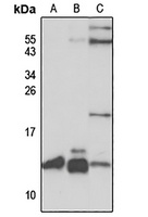 Anti-SLIRP Antibody