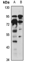 Anti-SLITRK4 Antibody