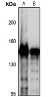 Anti-SMC4 Antibody