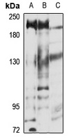 SMG6 antibody