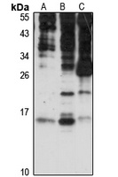 SNRNP25 antibody