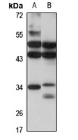 SNRNP35 antibody