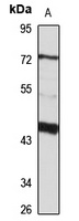 Anti-SNX17 Antibody