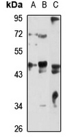 Anti-SNX6 Antibody