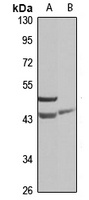 SNX7 antibody