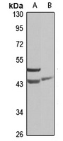Anti-SNX7 Antibody