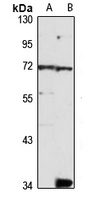 SOCS5 antibody