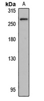 Anti-SorLA Antibody