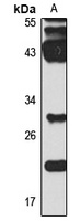 Anti-Sclerostin Antibody
