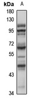 Anti-SOX4 Antibody
