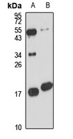 Anti-SRP14 Antibody