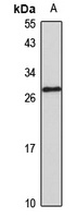 Anti-SC35 Antibody