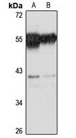 Anti-SRSF6 Antibody
