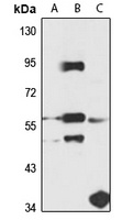 Anti-SS18L1 Antibody