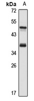 TRAP-alpha antibody