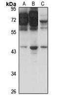 SSTR3 antibody