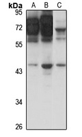 Anti-SSTR3 Antibody